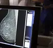 Outubro Rosa: Piauí faz 57 mil mamografias e recebe 224 medicamentos para câncer Outubro Rosa: Piauí faz 57 mil mamografias e recebe 224 medicamentos para câncer