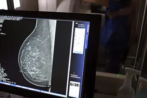 Teste de mamografia realizado na Campanha Outubro Rosa (Foto: José Cruz/Agência Brasil)