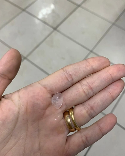 Granizo na palma da mão