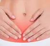 SUS vai ofertar novos tratamentos para reduzir progressão da endometriose