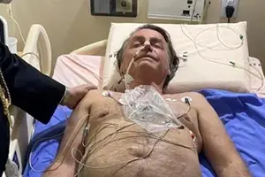 Bolsonaro sofre traumatismo craniano leve após queda, informa médico (Foto: Carta Capital)