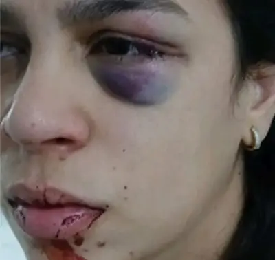 Corretora relata anos de violência e pede proteção no Piauí