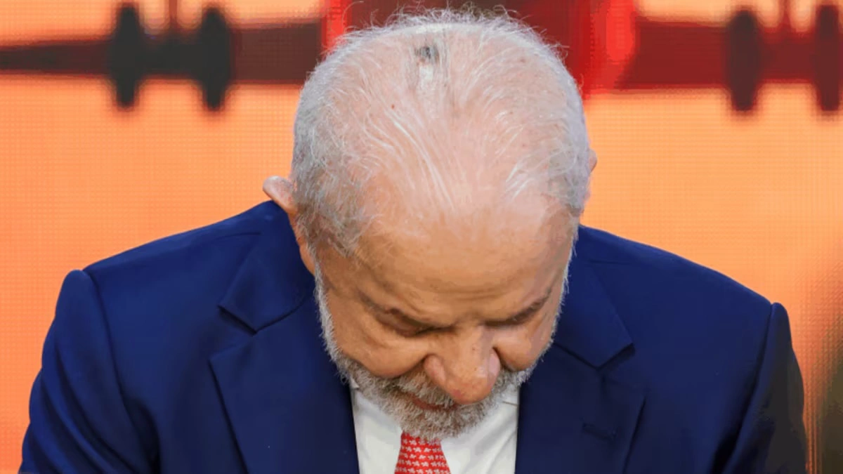 O presidente Lula aparece com lesão no couro cabeludo, em fevereiro de 2026