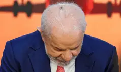 Lula passa por sessão de radioterapia preventiva no couro cabeludo