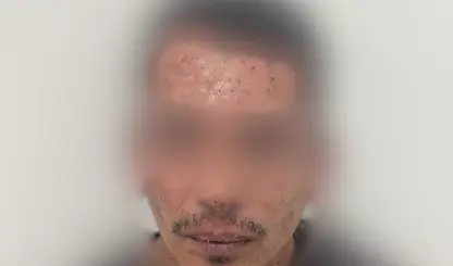 Suspeito de roubo é preso após fuga terminar em ataque de abelhas na zona Leste de Teresina